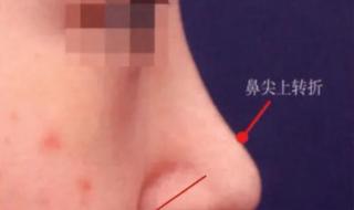 鼻头缩小要花多少钱 鼻头缩小要花多少钱
